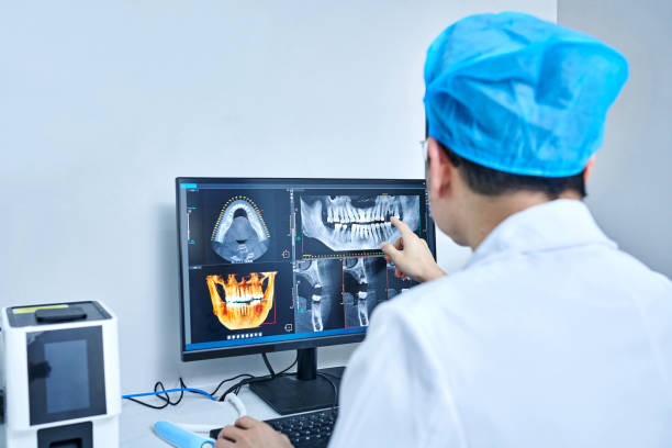 Best Emergency Root Canal Treatment in Bellevue, KY